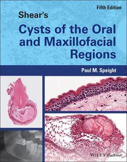 Shear's Cysts of the Oral and Maxillofacial Regions  (5th Edition)